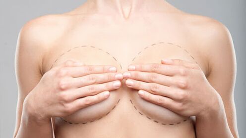 Funkce Operational Breast Awards