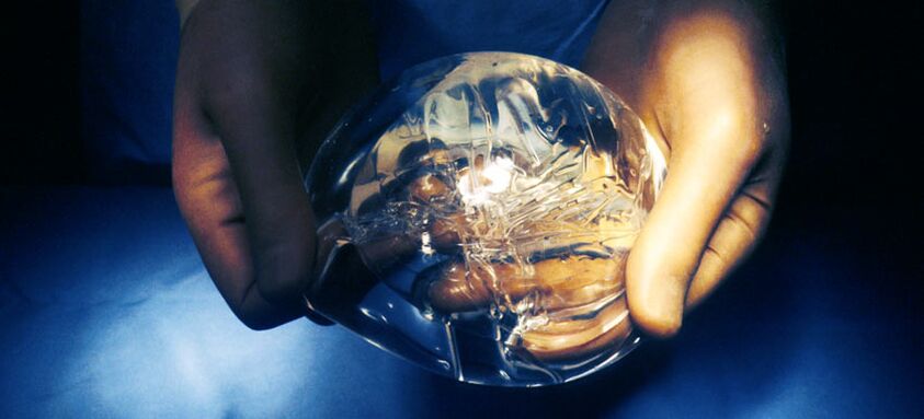 Silikonová endoprotéza